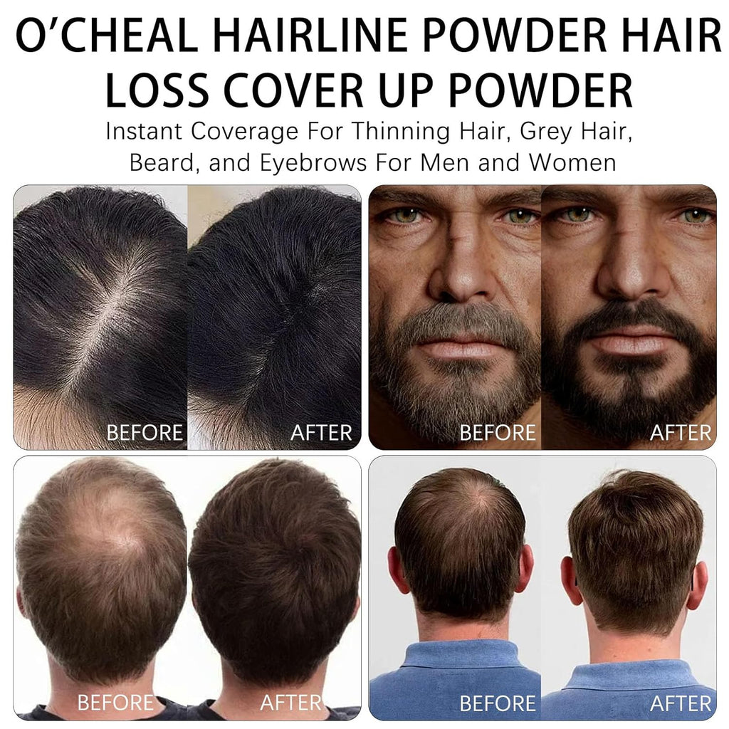 O'CHEAL Hairline Powder Dark Brown, Waterproof Hair Fibers for Thinning Hair, Instantly Root Touch Up Hair Color for Gray Hair Coverage, Long Lasting Hair Line Shadow Toppers Powder for Men and Women