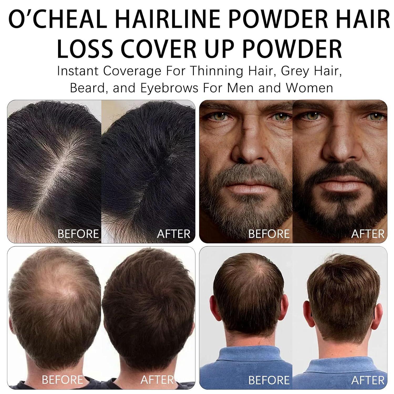 O'CHEAL Hairline Powder Dark Brown, Waterproof Hair Fibers for Thinning Hair, Instantly Root Touch Up Hair Color for Gray Hair Coverage, Long Lasting Hair Line Shadow Toppers Powder for Men and Women